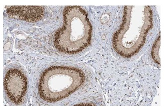 karyopherin β1 (H-7): sc-137016. Immunoperoxidase staining of formalin-fixed, paraffin-embedded human epididymis tissue showing nuclear staining of glandular cells. Kindly provided by The Swedish Human Protein Atlas (HPA) program.