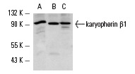 karyopherin β1 (N-19): sc-1919. Western blot analysis of karyopherin β1 expression in BJAB (A), Jurkat (B) and MDCK (C) whole cell lysates.