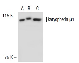karyopherin β1 (N-19): sc-1919. Western blot analysis of karyopherin β1 expression in non-transfected 293T: sc-117752 (A), mouse karyopherin β1 transfected 293T: sc-125509 (B) and Jurkat (C) whole cell lysates.