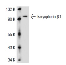 karyopherin β1 (N-19): sc-1919. Western blot analysis of karyopherin β1 expression in 293T whole cell lysate.