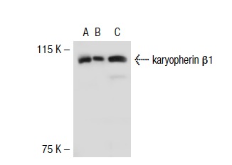 karyopherin β1 (C-19): sc-1863. Western blot analysis of karyopherin β1 expression in non-transfected 293T: sc-117752 (A), mouse karyopherin β1 transfected 293T: sc-125509 (B) and Jurkat (C) whole cell lysates.