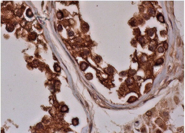 karyopherin β1 Antibody (C-19): sc-1863. Immunoperoxidase staining of formalin fixed, paraffin-embedded human testis tissue showing cytoplasmic and nuclear staining of cells in seminiferous ducts and Leydig cells.