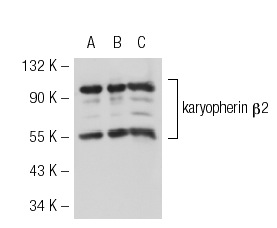 karyopherin β2 (D45): sc-32314. Western blot analysis of karyopherin β2 expression in non-transfected 293T: sc-117752 (A), human karyopherin β2 transfected 293T: sc-113602 (B) and HeLa (C) whole cell lysates.
