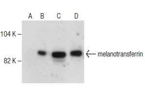 melanotransferrin (A-3): sc-271006. Western blot analysis of melanotransferrin expression in non-transfected 293T: sc-117752 (A), human melanotransferrin transfected 293T: sc-171124 (B) and SK-MEL-28 (C) whole cell lysates and human skin tissue extract (D).
