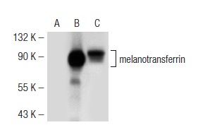 melanotransferrin (C-20): sc-26651. Western blot analysis of melanotransferrin expression in non-transfected 293T: sc-117752 (A), mouse melanotransferrin transfected 293T: sc-121600 (B) and SK-MEL-28 (C) whole cell lysates.