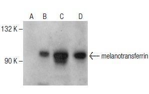 melanotransferrin (C-20): sc-26651. Western blot analysis of melanotransferrin expression in non-transfected 293T: sc-117752 (A), human melanotransferrin transfected 293T: sc-171124 (B) and SK-MEL-28 (C) whole cell lysates and human skin tissue extract (D).
