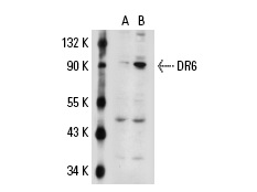 DR6 (E-17): sc-5866. Western blot analysis of DR6 expression in non-transfected: sc-117752 (A) and human DR6 transfected: sc-112295 (B) 293T whole cell lysates.