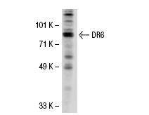 DR6 (E-17): sc-5866. Western blot analysis of DR6 expression in Jurkat whole cell lysate.
