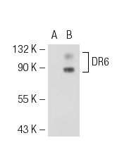 DR6 (E-17): sc-5866. Western blot analysis of DR6 expression in non-transfected: sc-117752 (A) and mouse DR6 transfected: sc-119843 (B) 293T whole cell lysates.