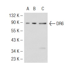 DR6 (E-17): sc-5866. Western blot analysis of DR6 expression in non-transfected 293: sc-110760 (A), human DR6 transfected 293: sc-113182 (B) and K-562 (C) whole cell lysates.