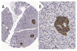DR6 (H-150): sc-25772. Immunoperoxidase staining of formalin fixed, paraffin-embedded human pancreas tissue showing cytoplasmic staining of islet cells at low (A) and high (B) magnification. Kindly provided by The Swedish Human Protein Atlas (HPA) program.