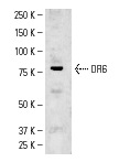 DR6 (H-150): sc-25772. Western blot analysis of DR6 expression in Jurkat whole cell lysate.