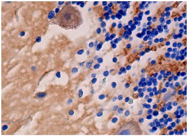 DR6 (H-150): sc-25772. Immunoperoxidase staining of formalin fixed, paraffin-embedded human cerebellum tissue showing cytoplasmic staining of cells in granular and molecular layers and Purkinje cells.