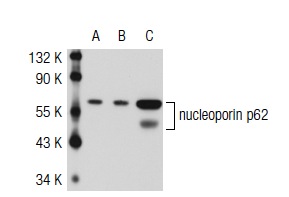 nucleoporin p62 (2A11): sc-101543. Western blot analysis of nucleoporin p62 expression in non-transfected 293T: sc-117752 (A), human nucleoporin p62 transfected 293T: sc-116305 (B) and HeLa (C) whole cell lysates.