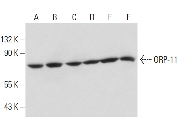 ORP-11 (N-14): sc-103101. Western blot analysis of ORP-11 expression in HeLa (A), NIH/3T3 (B), JAR (C), RPE-J (D) and IMR-32 (E) whole cell lysates and mouse brain tissue extract (F).