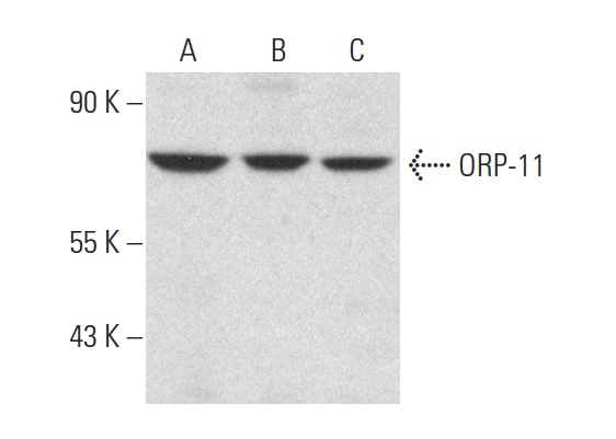 ORP-11 (N-14): sc-103101. Western blot analysis of ORP-11 expression in SHP-77 (A), IMR-32 (B) and JEG-3 (C) whole cell lysates.