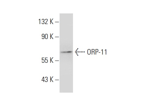ORP-11 (N-14): sc-103101. Western blot analysis of ORP-11 expression in SHP-77 (A) and JEG-3 (B) whole cell lysates and mouse skeletal muscle tissue extract (C).