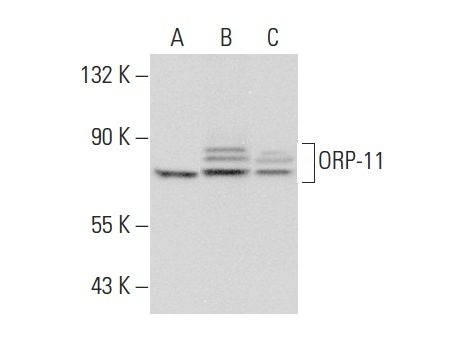 ORP-11 (N-14): sc-103101. Western blot analysis of ORP-11 expression in PC-12 whole cell lysate (A) and human brain (B) and mouse brain (C) tissue extracts.