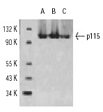 p115 (H-11): sc-48363. Western blot analysis of p115 expression in HeLa (A), Hep G2 (B) and c4 (C) whole cell lysates.