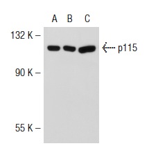 p115 (H-11): sc-48363. Western blot analysis of p115 expression in non-transfected 293T: sc-117752 (A), human p115 transfected 293T: sc-115193 (B) and HeLa (C) whole cell lysates.