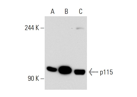 p115 (H-11): sc-48363. Western blot analysis of p115 expression in non-transfected 293T: sc-117752 (A), human p115 transfected 293T: sc-115193 (B) and Hep G2 (C) whole cell lysates.