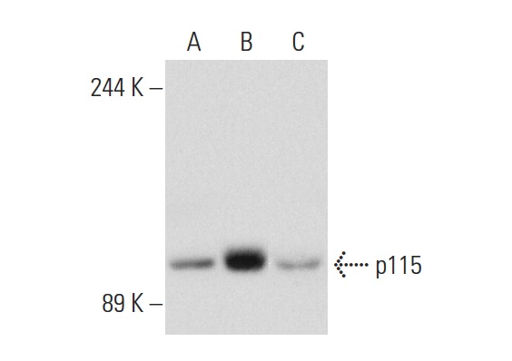 p115 (H-11): sc-48363. Western blot analysis of p115 expression in non-transfected 293T: sc-117752 (A), human p115 transfected 293T: sc-175430 (B) and HeLa (C) whole cell lysates.