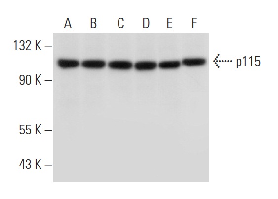 p115 (H-11): sc-48363. Western blot analysis of p115 expression in MCF7 (A), Jurkat (B), Hep G2 (C), HeLa (D), MES-SA/D x5 (E) and HEK293 (F) whole cell lysates.