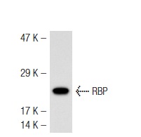 RBP (F-12): sc-46688. Western blot analysis of RBP expression in Hep G2 whole cell lysate.