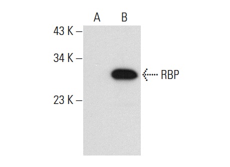 RBP (F-12): sc-46688. Western blot analysis of RBP expression in non-transfected: sc-117752 (A) and human RBP transfected: sc-170840 (B) 293T whole cell lysates.
