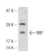 RBP (FL-201): sc-25850. Western blot analysis of RBP expression in Hep G2 whole cell lysate.