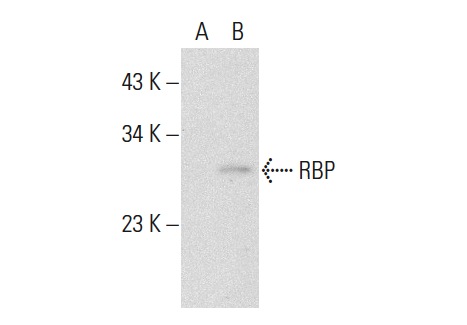 RBP (FL-201): sc-25850. Western blot analysis of RBP expression in non-transfected: sc-117752 (A) and human RBP transfected: sc-170840 (B) 293T whole cell lysates.