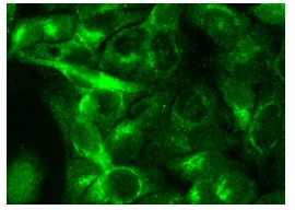 RBP (FL-201): sc-25850. Immunofluorescence staining of formalin-fixed Hep G2 cells showing cytoplasmic localization.