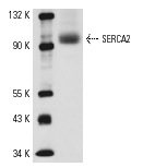 SERCA2 (C-20): sc-8094. Western blot analysis of SERCA2 expression in rat heart extract.