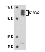 SERCA2 (IID8): sc-53010. Western blot analysis of SERCA2 expression in MDCK whole cell lysate.