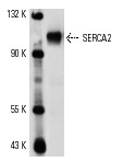 SERCA2 (N-19) : sc-8095. Western blot analysis of SERCA2 expression in rat cardiac tissue extract.