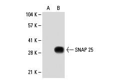 SNAP 25 (4E203): sc-73044. Western blot analysis of SNAP 25 expression in non-transfected: sc-110760 (A) and human SNAP 25 transfected: sc-111113 (B) 293 whole cell lysates.