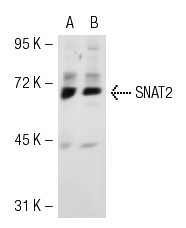 SNAT2 (H-60): sc-67081. Western blot analysis of SNAT2 expression in non-transfected: sc-117752 (A) and mouse SNAT2 transfected: sc-123678 (B) 293T whole cell lysates.
