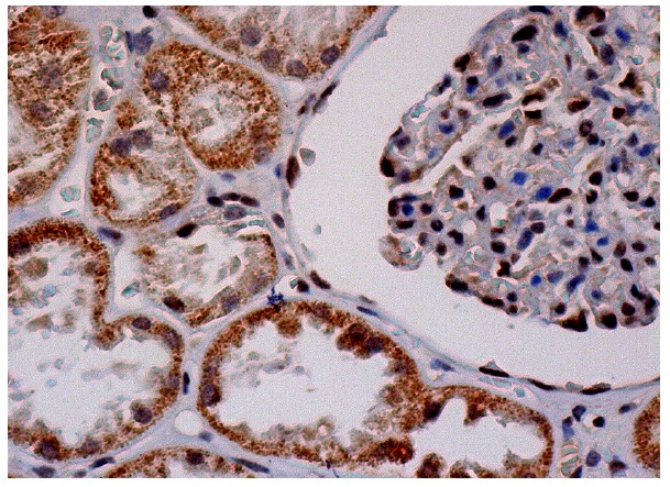 SNAT2 (H-60): sc-67081. Immunoperoxidase staining of formalin fixed, paraffin-embedded human kidney tissue showing cytoplasmic staining of cells in glomeruli and nuclear staining of cells in tubules.