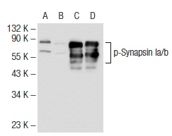 Western blot analysis of Synapsin Ia/b phosphorylation in untreated (A, C) and lambda protein phosphatase treated (B, D) rat brain tissue extracts. Antibodies tested include p-Synapsin Ia/b (Ser 62/Ser 67): sc-135709 (A, B) and Synapsin Ia/b (H-170): sc-20780 (C, D).
