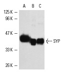 SYP (D-4): sc-17750. Western blot analysis of SYP expression in IMR-32 (A) whole cell lysate and rat (B) and mouse (C) brain extracts.