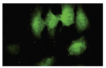 Tom34 (S-05): sc-101284. Immunofluorescence staining of paraformaldehyde-fixed HeLa cells showing cytoplasmic localization.