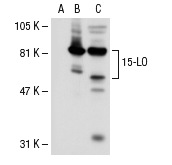 15-LO (H-235): sc-32940. Western blot analysis of 15-LO expression in non-transfected 293T: sc-117752 (A), human 15-LO transfected 293T: sc-114262 (B) and human PBL (C) whole cell lysates.
