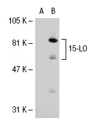 15-LO (V-17): sc-27354. Western blot analysis of 15-LO expression in non-transfected: sc-117752 (A) and human 15-LO transfected: sc-114262 (B) 293T whole cell lysates.