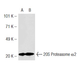 20S Proteasome α2 (H-120): sc-67339. Western blot analysis of 20S Proteasome α2 expression in WI 38 (A) and MES-SA/Dx5 (B) whole cell lysates.