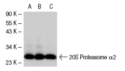 20S Proteasome α2 (H-120): sc-67339. Western blot analysis of 20S Proteasome α2 expression in non-transfected 293T: sc-117752 (A), human 20S Proteasome α2 transfected 293T: sc-116165 (B) and HeLa (C) whole cell lysates.