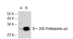 20S Proteasome α5 (H-53): sc-67342. Western blot analysis of 20S Proteasome α5 expression in non-transfected: sc-117752 (A) and mouse 20S Proteasome α5 transfected: sc-117885 (B) 293T whole cell lysates.