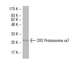 20S Proteasome α7 (GH6): sc-100456. Western blot analysis of 20S Proteasome α7 expression in human omentum, serous carcinoma tissue extract.