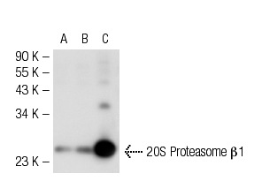 20S Proteasome β1 (FL-241): sc-67345. Western blot analysis of 20S Proteasome β1 expression in non-transfected 293T: sc-117752 (A), mouse 20S Proteasome β1 transfected 293T: sc-117880 (B) and JAR (C) whole cell lysates.