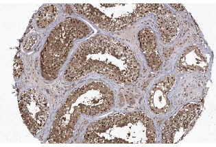 20S Proteasome β1 (FL-241): sc-67345. Immunoperoxidase staining of formalin fixed, paraffin-embedded human testis showing nuclear and cytoplasmic staining of cells in seminiferus ducts & Leydig cells at low magnification. Kindly provided by The Swedish Human Protein Atlas (HPA) program.