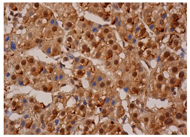 20S Proteasome β1 (FL-241): sc-67345. Immunoperox-idase staining of formalin fixed, paraffin-embedded human adrenal gland tissue showing cytoplasmic and nuclear staining of glandular cells.